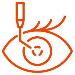 cataract-surgery-icon